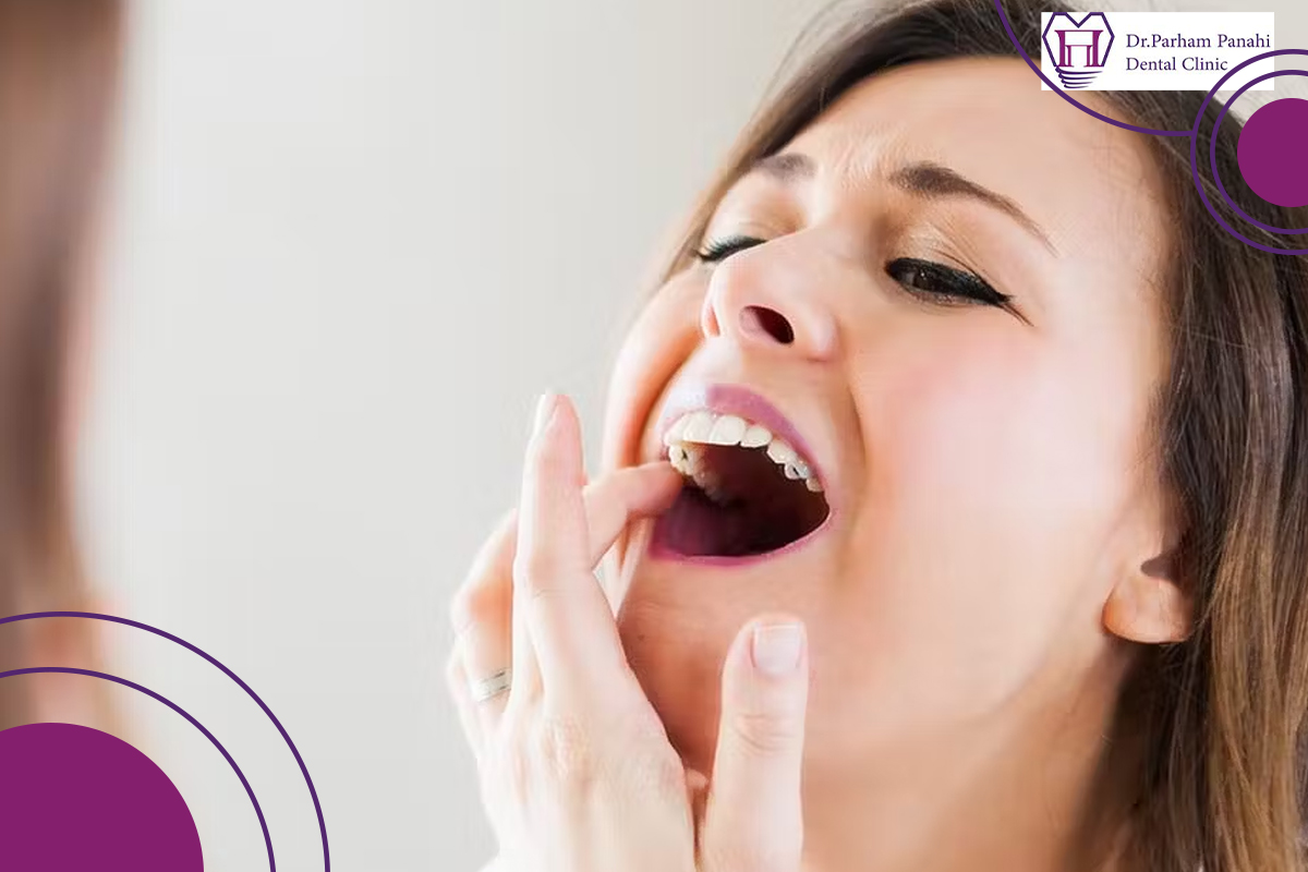 علائم  ضربان در لثه