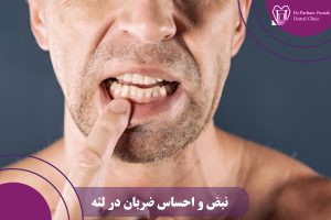 ضربان در لثه
