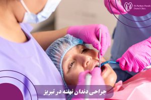 جراحی دندان نهفته در تبریز