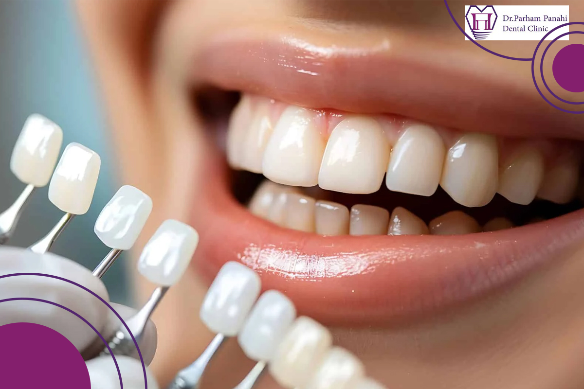 هزینه دندانپزشکی زیبایی در تبریز