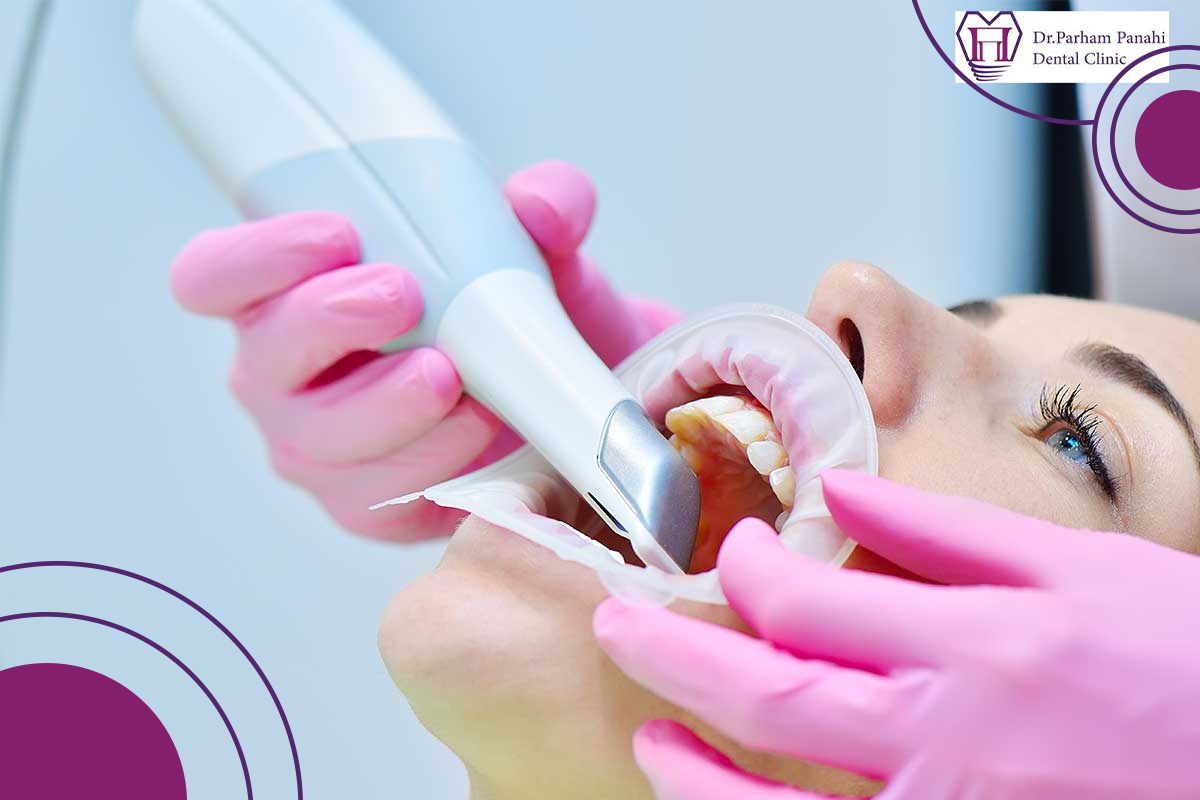 فناوریهای مدرن برای ساخت روکش سرامیکی در تبریز