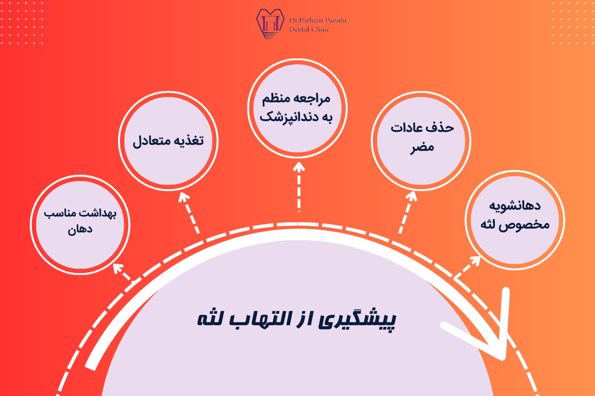 پیشگیری از التهاب لثه