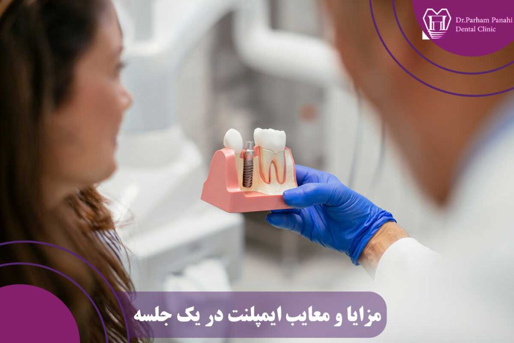 مزایا و معایب ایمپلنت در یک جلسه