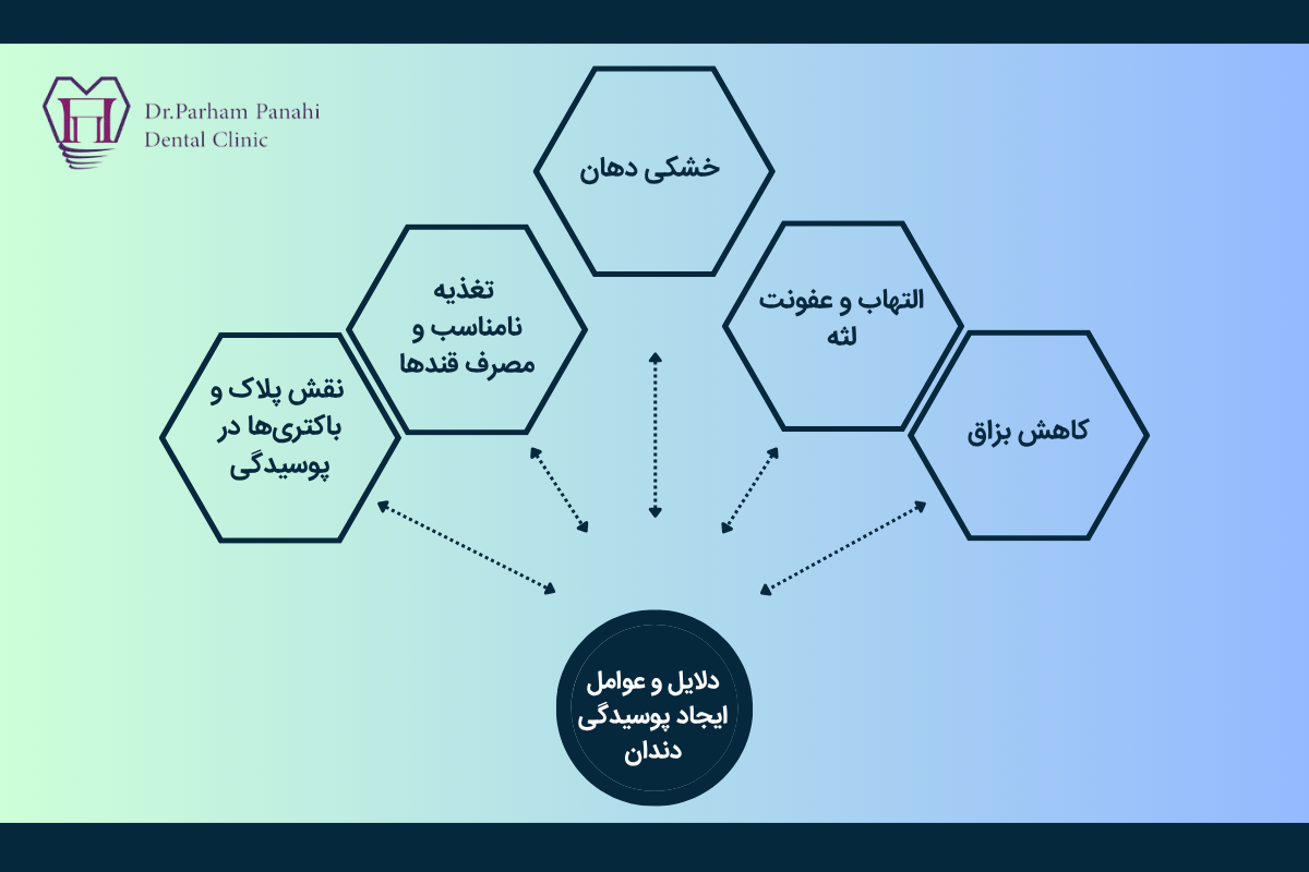 دلایل و عوامل ایجاد پوسیدگی دندان