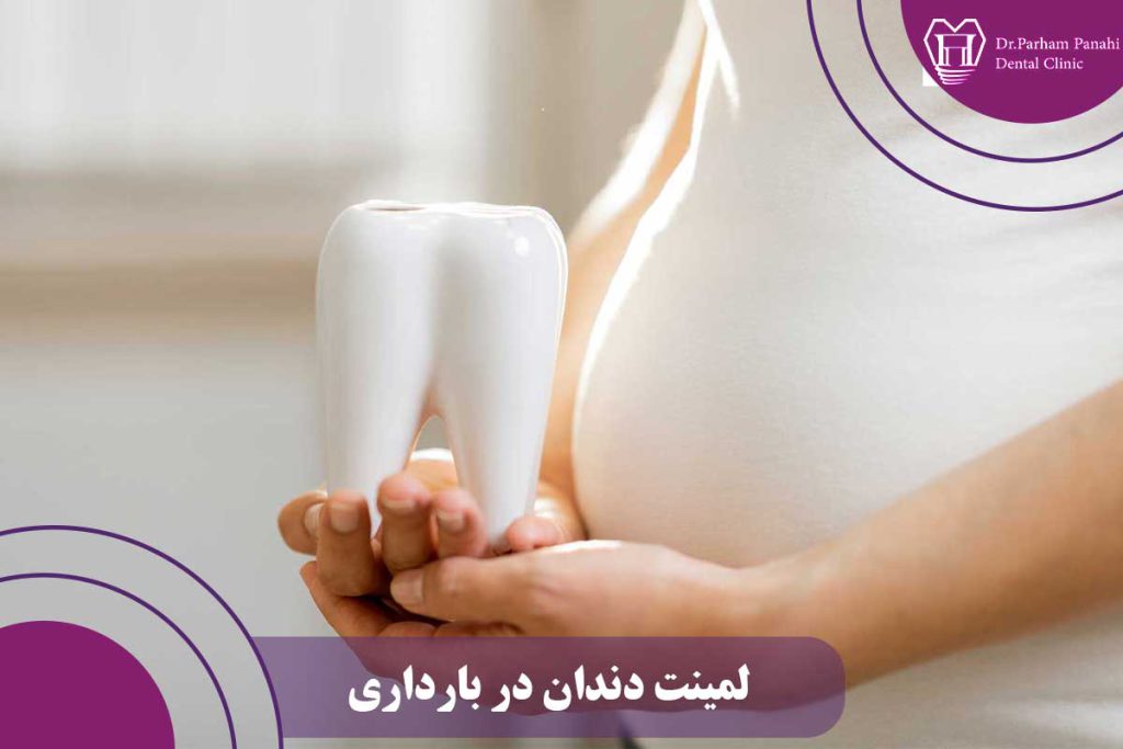 لمینت دندان در بارداری