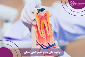 مراقبت های بعد از عصب کشی دندان