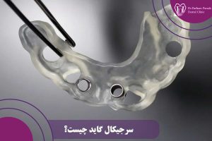 سرجیگال گاید