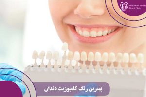 بهترین رنگ کامپوزیت دندان