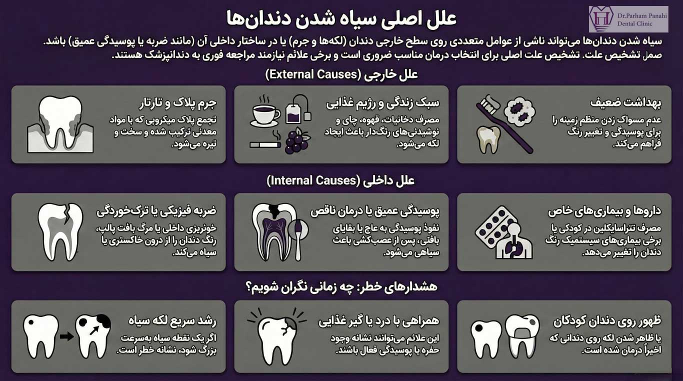 مهم‌ترین علل سیاه شدن دندان (علت‌های داخلی و خارجی)