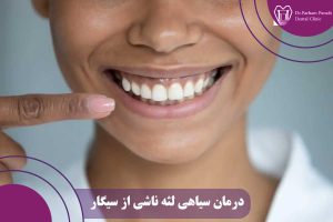 درمان سیاهی لثه ناشی از سیگار