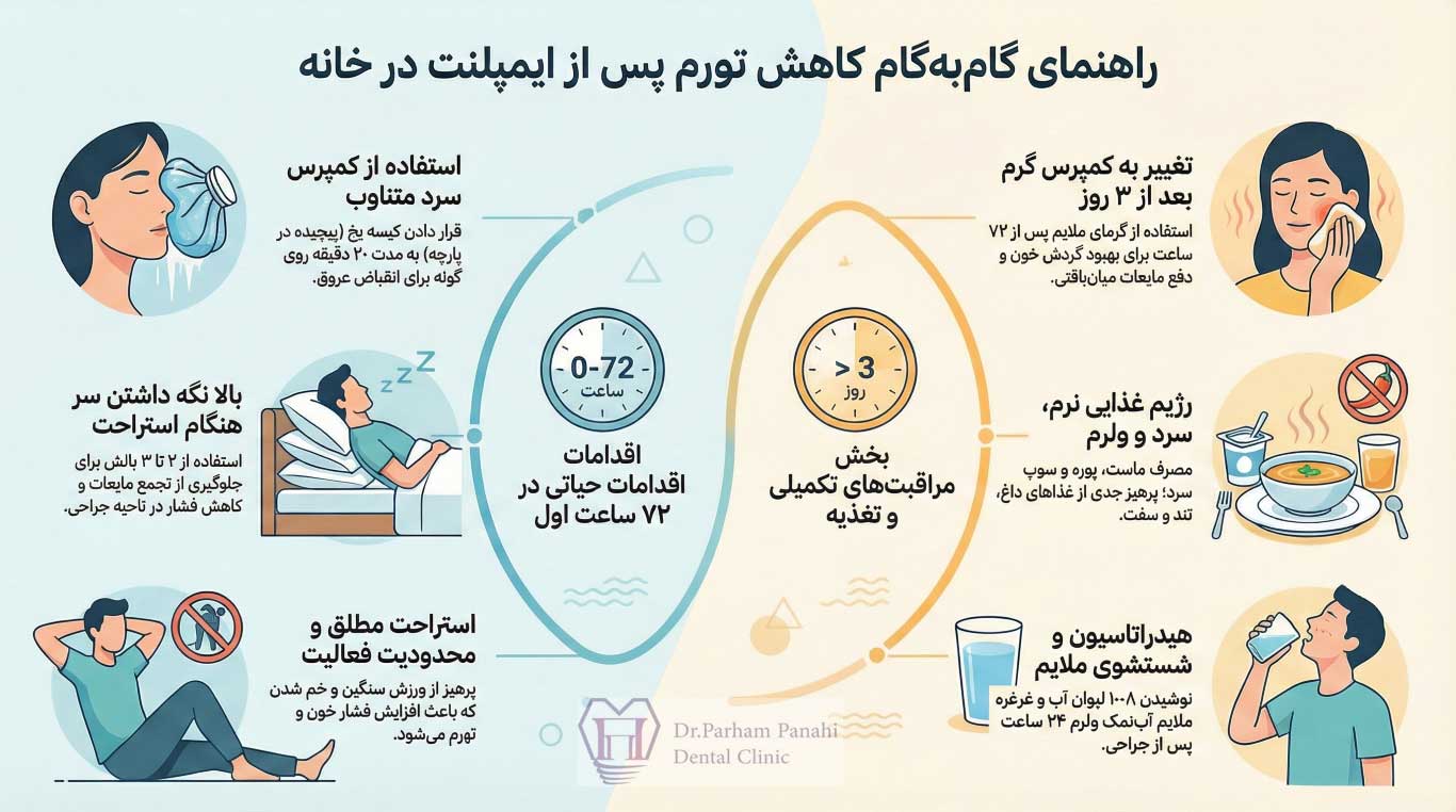 درمان‌های خانگی برای کاهش سریع تورم بعد از ایمپلنت