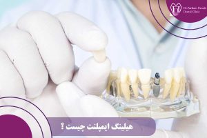 هیلینگ ایمپلنت