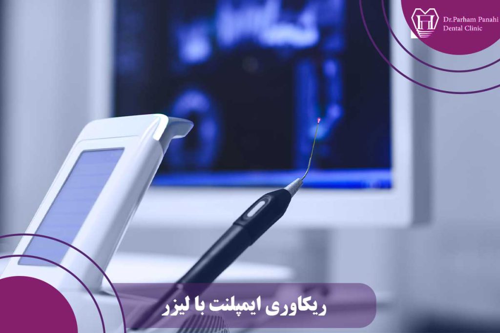 ریکاوری ایمپلنت با لیزر