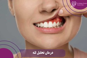 درمان تحلیل لثه