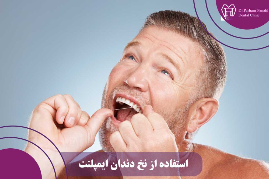 استفاده از نخ دندان ایمپلنت