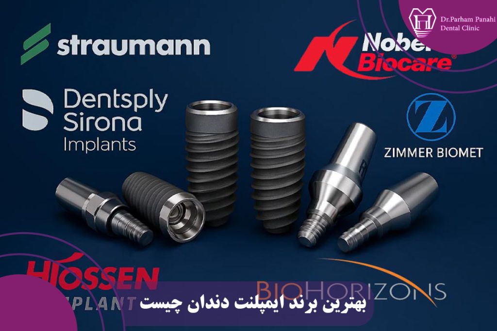 بهترین برند ایمپلنت دندان چیست؟