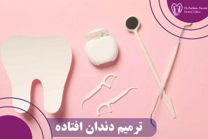 ترمیم دندان افتاده