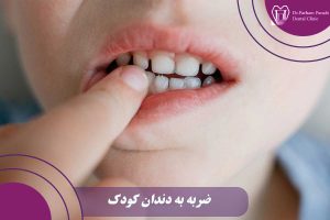ضربه به دندان کودک