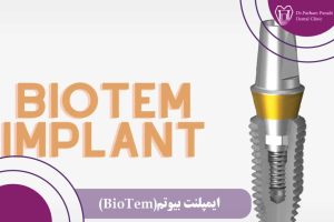 ایمپلنت بیوتم (BioTem)