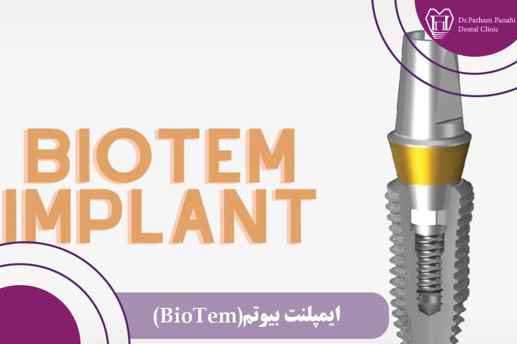 ایمپلنت بیوتم (BioTem)