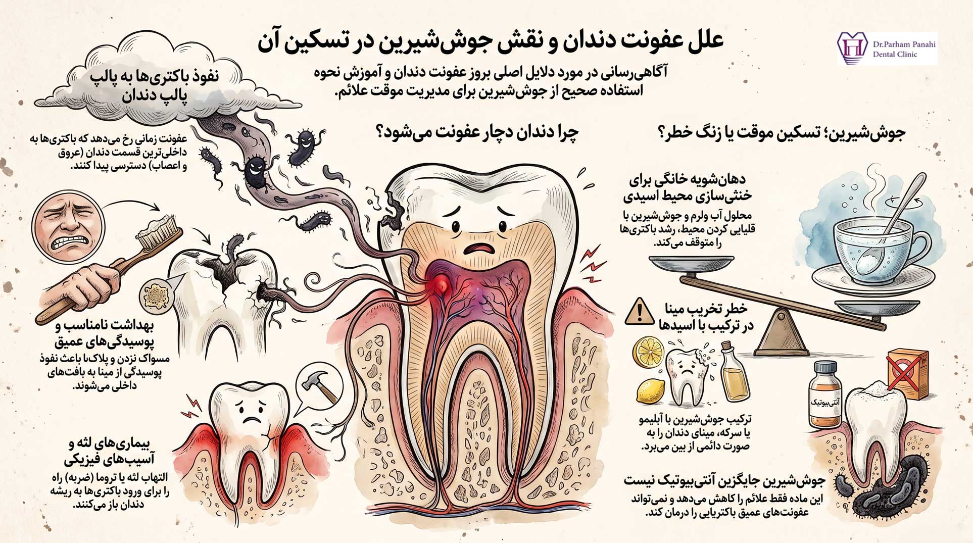 دلایل عفونت دندان
