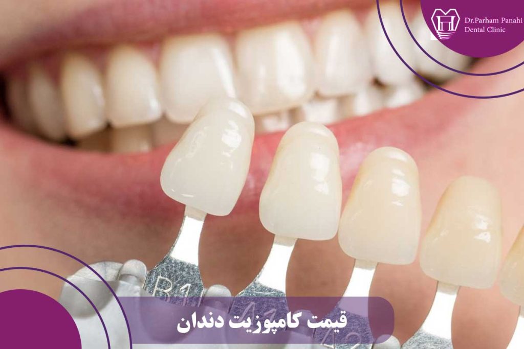 قیمت کامپوزیت دندان