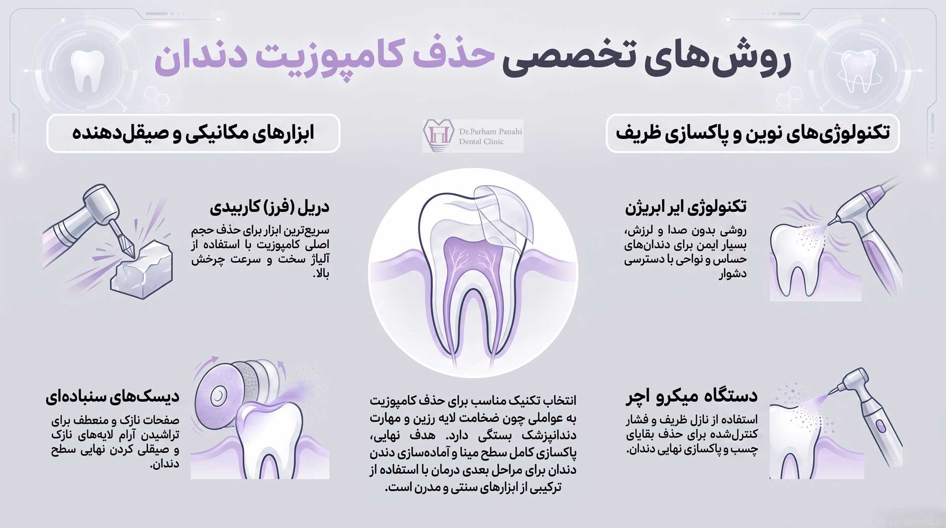 روش‌های حذف کامپوزیت دندان