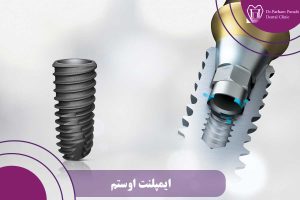 ایمپلنت اوستم